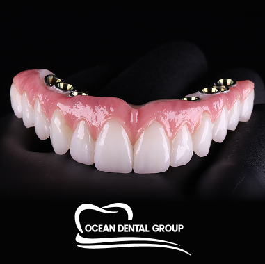 Zirconia Implant Bridge